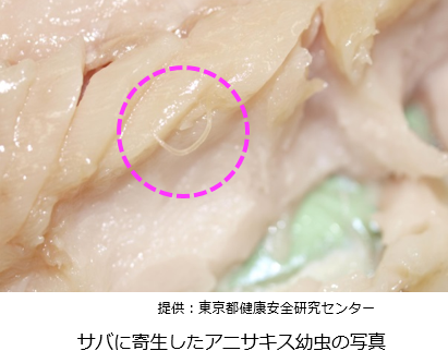アニサキスの特徴の画像2